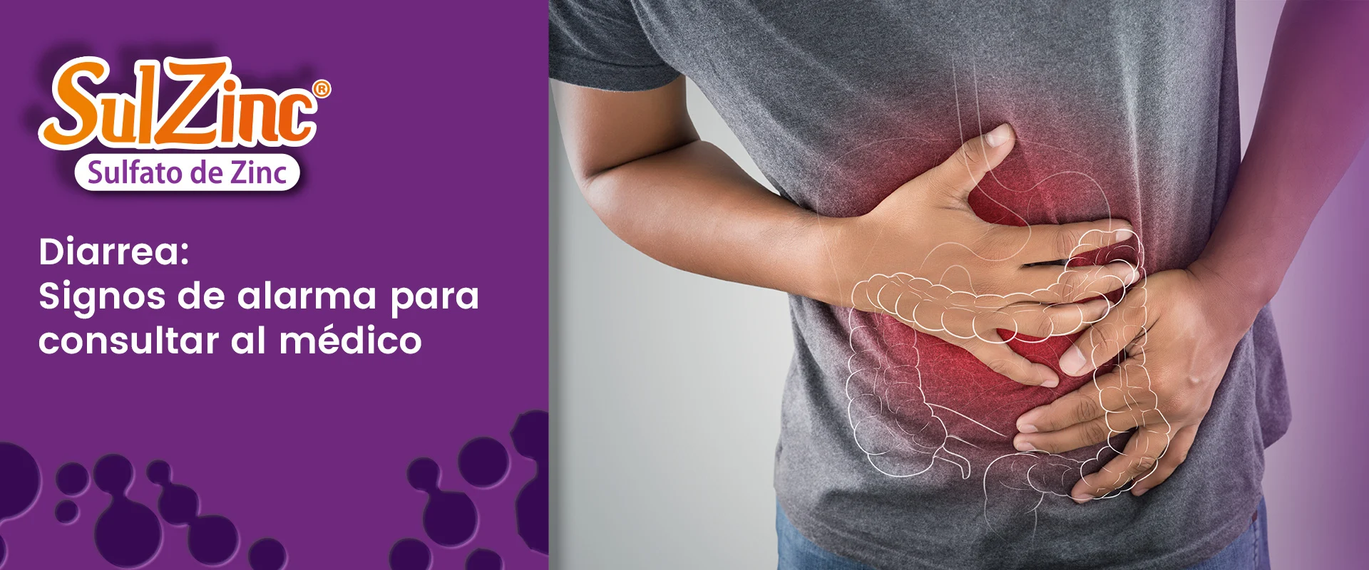 Diarrea: Signos de alarma para consultar al médico